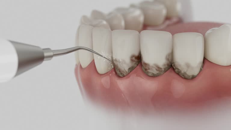 Reliable Dental contractor in Parachute, CO by Smile Center Dentistry